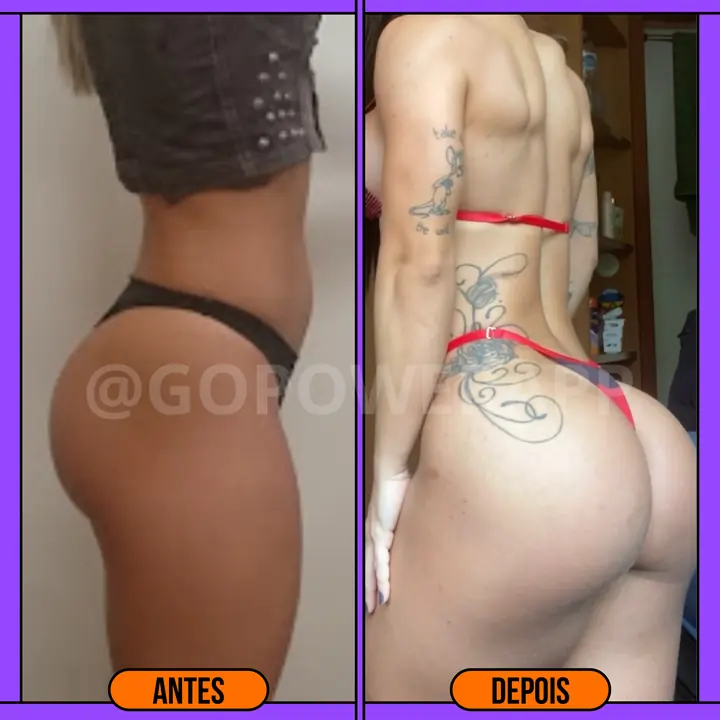 Antes e depois do glúteo de aluna Power