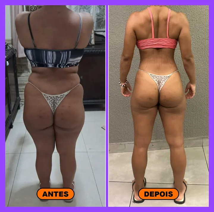 Antes e depois do glúteo de aluna Power